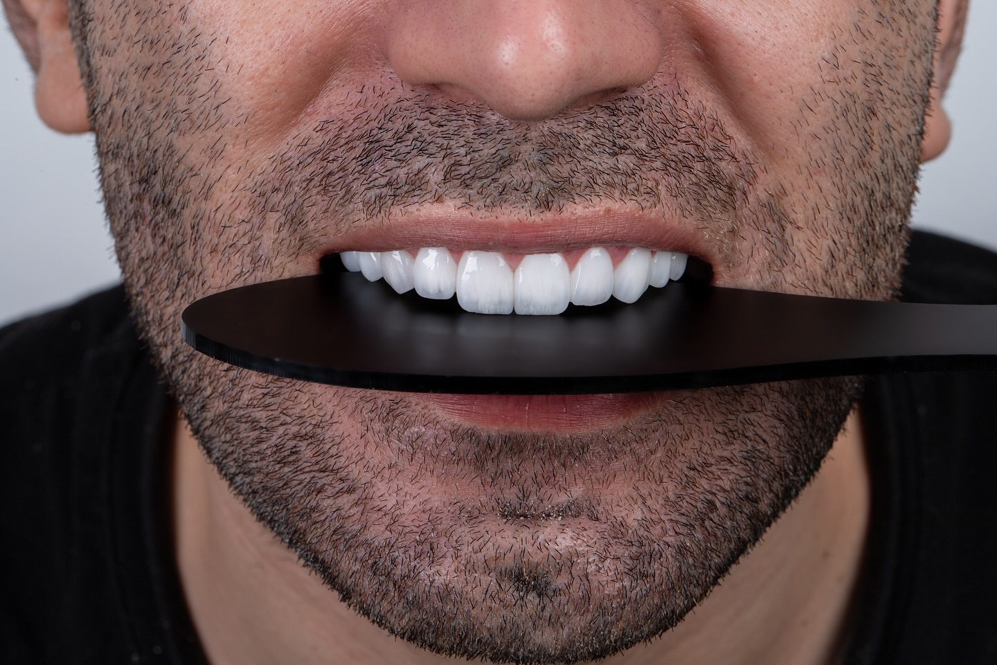نمونه لمینت طبیعی و هماهنگ با چهره