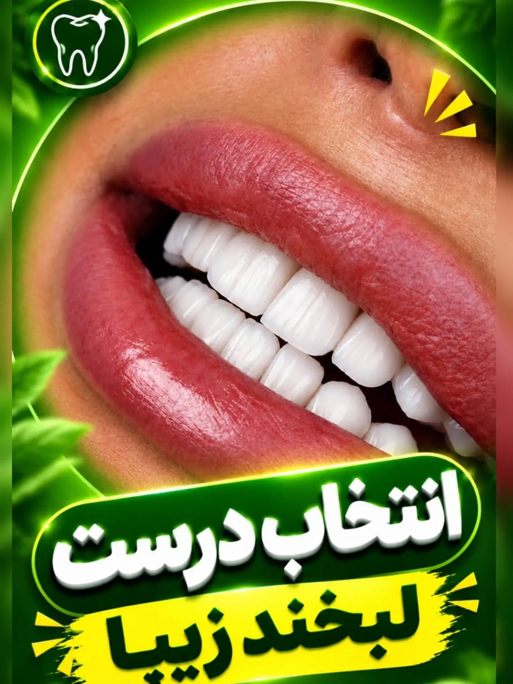 نمونه لمینت IPS